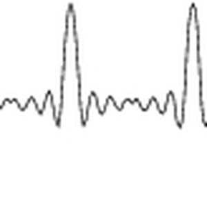 Bei dieser Signalabfolge aus Sinus, Sin(x)Ix und Pulsen wird je eine Periode dieser drei Funktionen in drei Speichersegmenten abgespeichert. Die Sequenz definiert, wie oft das jeweilige Segment ausgegeben werden soll und welches Segment als nächstes drankommt.