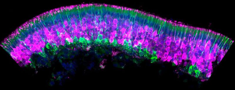 Riechepithel, ein auf die Sinneswahrnehmung von Gerüchen spezialisiertes Gewebe, eines Nacktmulls: Das Immunfluoreszenzbild zeigt reife Riechzellen (magenta), unreife Riechzellen (grün) und Zellkerne (blau).(Bild:  © Mohammed Khallaf, Lewin Lab, Max Delbrück Center)