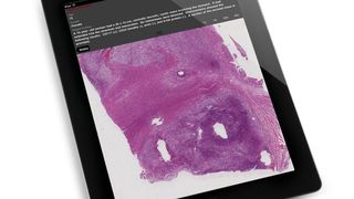Mit Slide Path Gateway für das iPad steht die Digitale Pathologie auf Tastendruck zur Verfügung.  (Bild: Leica)