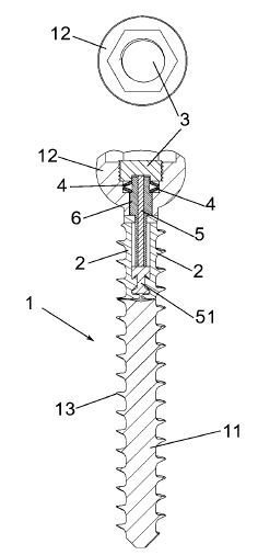 Eine Implantatschraube.(Bild:  DPMA)