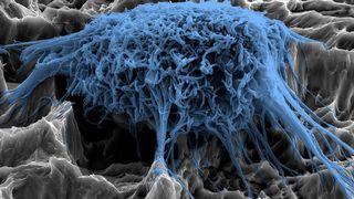 Rasterelektronenmikroskopische Aufnahme einer gut angewachsenen Zelle auf einem Zahnimplantat. (Bild: Fraunhofer IFAM)