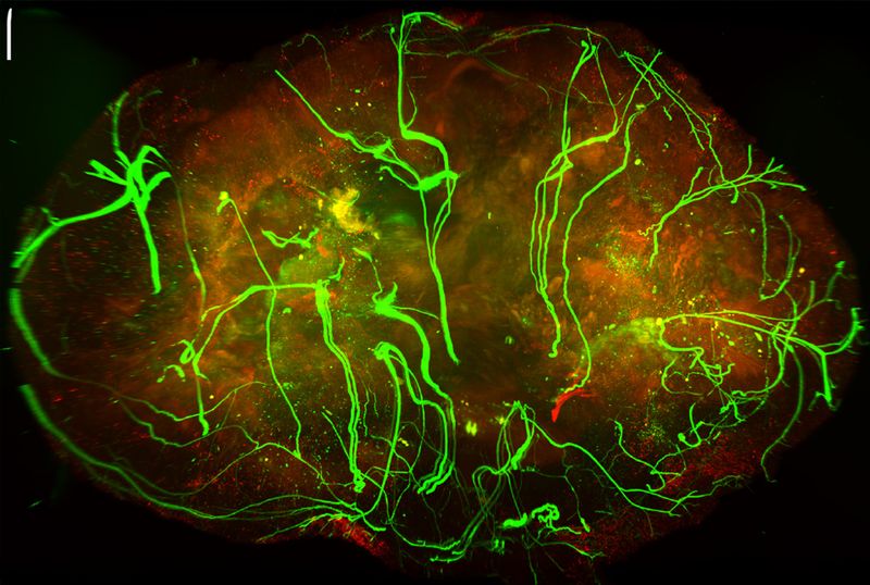 Nerven in der Haut bremsen Melanome   Nervenfasern in Melanomen können das Wachstum dieser Tumore verlangsamen. Das zeigt eine Studie unter Leitung von Forschenden des Weill Cornell Medicine.  Die Wissenschaftler untersuchten an Mausmodellen des Hautkrebses Melanom das Vorkommen und die Auswirkungen peripherer Nerven, die in Tumore hineinwachsen. Sie fanden heraus, dass Nerven des sympathischen Nervensystems oft zahlreich in solchen Tumoren vorkommen. Diese Nerven können das Tumorwachstum hemmen, indem sie lokal vorhandene tumorfördernde Makrophagen – eine Art Immunzellen – reduzieren.  Die Forschenden nutzten eine Technik namens Whole-Mount-Immunmarkierung, bei der eine gesamte Gewebeprobe optisch transparent gemacht wird, um die Nerven in den Tumoren zu zählen, zu identifizieren und ihre Pfade nachzuverfolgen.  Diese Untersuchungen zeigten, dass schmerzempfindliche Nerven und sympathische Nerven in den Melanomen weit verbreitet waren und mit dem Tumorwachstum zunahmen – besonders in langsamer wachsenden Tumoren. Die schmerzempfindlichen Nerven schienen eine tumorfördernde Wirkung zu haben. Die sympathischen Nerven hingegen übten überraschenderweise eine tumorhemmende Wirkung aus.  Die Ergebnisse bringen das noch recht neue Feld der Krebs-Neurowissenschaften voran und könnten künftige Therapiestrategien beeinflussen.  Das Bild zeigt: Nerven (in grün) in einem Melanom-Tumor.    Hier gehts zur Originalmeldung Wissenschaftsbild des Tages vom 7.5.2026  (Bild: Dr. David J. Simon)
