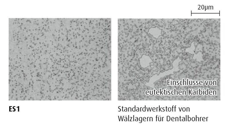 Abbildung 1: Vergleich der Mikrostruktur von konventionellen Lagern für Dentalbohrer (rechts) und solchen aus ES1 (links).