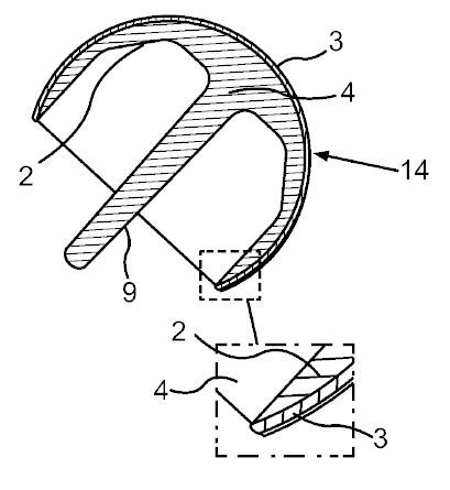 Eine Endoprothese, Verfahren zu deren Herstellung und Verwendung einer Endoprothese.(Bild:  DPMA)