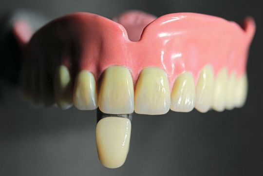 Natürlicher Zahnersatz aus dem 3D-Drucker: Eine Zusatzsoftware ermöglicht, Farbe und Transluzenz vor dem physischen Fertigen virtuell zu prüfen.(Bild:  Fraunhofer)