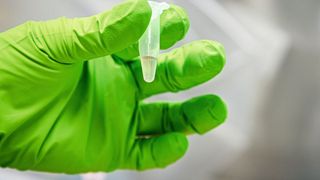 Abwasserprobe vor der Sequenzierung (Bild: Felix Petermann, Max Delbrück Center)