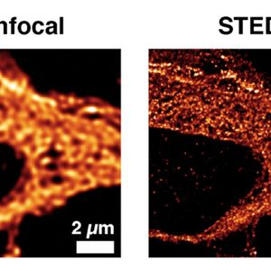 (Bild: Leibniz-Institut für Ostseeforschung/Universitätsmedizin Göttingen)