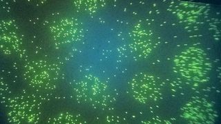 Fluoreszierende Legionellen (Blue Lab)