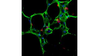 Das Molekül Wnt5a ist verantwortlich dafür, dass bei COPD Patienten Strukturen der Lunge (hier dargestellt das Lungenbläschen-Epithel in Grün und Immunzellen in Rot) nicht mehr heilen. (HMGU)