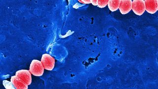 Streptococcus pyogenes (rot) dringt in humane Endothelzellen (HUVEC) ein (Bild: HZI / M. Rohde)