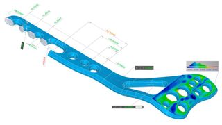 Intelligente Softwareverfahren in der Messsoftware Win Werth ermöglichen beispielsweise fertigungsbegleitende Implantatmessungen mit minimalen Zykluszeiten. (Bild: Werth Messtechnik)