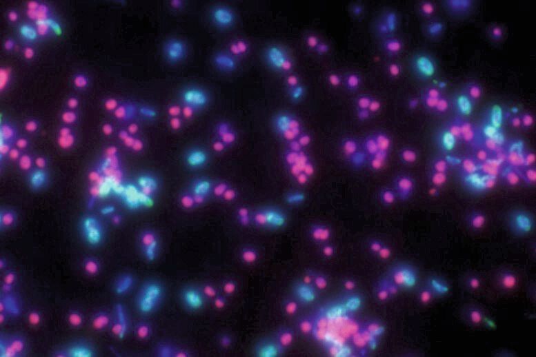 Die Fluoreszenzmikroskopie zeigt Candidatus Argoarchaeum ethanivorans in Magenta und die sulfatreduzierenden Bakterien in Cyan. (Niculina Musat / UFZ)