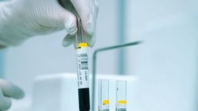 The new method, Bayescna, can extract information that was previously hidden in low-quality samples and provide more detail about the tumor’s composition.  (Source: Unsplash)