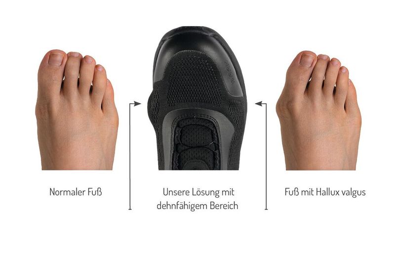 Der Sicherheitsschuh verfügt laut Hersteller über einen dehnfähigen Bereich, der auch bei Hallux valgus für mehr Bewegungsfreiheit sorgen soll. (Bild: Baak)
