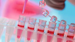 Abb. 1: In vielen Laboren fallen täglich mehrere Säcke mit Verbrauchsmaterialien wie Zellkulturflaschen, Pipettenspitzen, Laborhandschuhen und Verpackungen an. Muss das alles sein? (Bild: ©luchschen - stock.adobe.com)