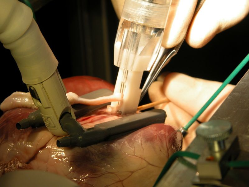 Mechatronik in der Medizin ist in der Lage bei komplizierten Eingriffen die Belastung von Patient und Chirurg wesentlich zu verringern (Bild: automatisierte Bypassoperation am schlagenden Herzen). (Bild: ZHAW)