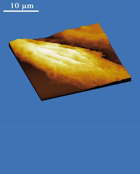 Abb.4: Dreidimensionale AFM-Aufnahme eines Myoblasts (Muskelvorläuferzelle), das am Heilungsprozess nach muskulären Verletzungen beteiligt ist. (Archiv: Vogel Business Media)