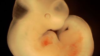 Forscher der Universität Bonn haben mit Kollegen aus Japan und den Niederlanden eine Methode entwickelt, mit der sich dieser Massen-Zelluntergang in Embryonen der Maus filmen lässt. (Symbolbild Mausembryo) (Natalia Sinjushina and Evgeniy Meyke)