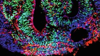 Mithilfe von Mini-Organen – wie hier Hirn-Organoiden – kann man die Techniken der Einzelzellanalyse auch auf menschliche Gewebe anwenden. Forschende sehen so, wie menschliche Zellen im Verlauf des Lebens reifen, wie sich Gewebe regenerieren und welche Veränderungen zu Krankheiten führen.  (© Agnieszka Rybak Wolf, Arbeitsgruppe von Nikolaus Rajewsky am BIMSB / MDC )