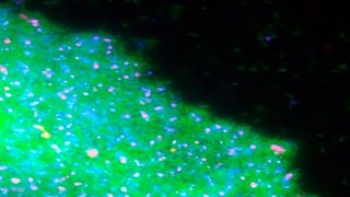 Fluorescence image of a Caulobacter biofilm. Live cells are labelled in green, dead ones in pink, and extracellular DNA release during cell death is shown in blue. (Source: CÉCILE BERNE)