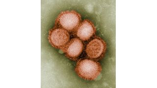 Abb. 1: Koloriertes, elektronenmikroskopisches Bild einiger Influenza-A/H1N1-Viren [5].  (Bild: Analytik Jena)