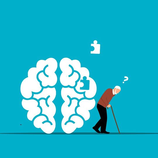 Research indicates that high blood levels of NfL reflect the severity of atrophy in several overlapping brain regions. Research indicates that high blood levels of NfL reflect the severity of atrophy in several overlapping brain regions.
