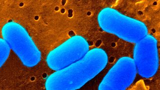 Mit dem Corynebacterium glutamicum werden jährlich mehrere Millionen Tonnen Aminosäuren produziert, wie zum Beispiel der Futtermittelzusatz L-Lysin. Das Bakterium dient jedoch auch als ungefährlicher Modellorganismus für den eng verwandten Erreger der Tuberkulose, mit dem es viele Gemeinsamkeiten hat. (Bildausschnitt) (Bild: Forschungszentrum Jülich)