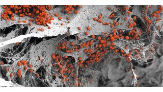 Rasterelektronenmikroskopische Aufnahme des künstlich hergestellten 3D-Knochenmarkgewebes, das mit menschlichen Blutzellen (rot) besiedelt ist.  (Bild: Andrés García García, Universität Basel, Departement Biomedizin)