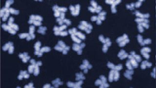 Menschliche Chromosomen im Mikroskop. Auf diesem Bild sind die Chromosomen intakt, .... (Ausschnitt) (ETH Zürich / Jiradet Gloggnitzer)