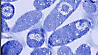 Elektronenmikroskopische Aufnahme von Dünnschnitten der E. coli-Bakterien.  (Bild: Dr. Jeannette Winter/TU München)
