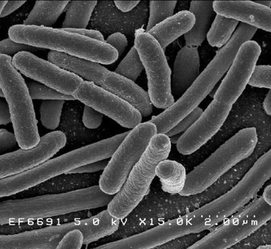 E. coli ist eine der viele Bakterienarten, die den Darm besiedeln. E. coli ist eine der viele Bakterienarten, die den Darm besiedeln.
