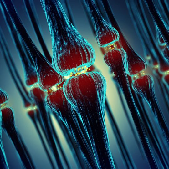Multiple Sklerose (MS) ist eine chronisch-entzündliche Autoimmunerkrankung des zentralen Nervensystems, bei der die Isolierschichten der Nervenfasern zerstört werden. Multiple Sklerose (MS) ist eine chronisch-entzündliche Autoimmunerkrankung des zentralen Nervensystems, bei der die Isolierschichten der Nervenfasern zerstört werden.