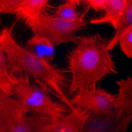 Endothelzellen unter dem Mikroskop: Beim Experiment Spheroids wollen Wissenschaftler die Auswirkungen der Schwerelosigkeit auf menschliche Blutgefäßzellen (Endothelzellen) untersuchen. Auf dem Bild wurden die Kerne der Zellen blau und das Aktin-Cytoskelett mit Antikörpern rot gefärbt. Endothelzellen unter dem Mikroskop: Beim Experiment Spheroids wollen Wissenschaftler die Auswirkungen der Schwerelosigkeit auf menschliche Blutgefäßzellen (Endothelzellen) untersuchen. Auf dem Bild wurden die Kerne der Zellen blau und das Aktin-Cytoskelett mit Antikörpern rot gefärbt.