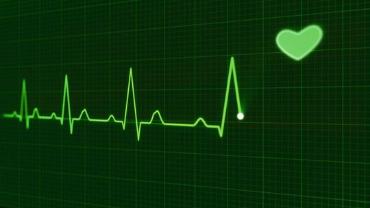 Bloß keinen Prüfstress: Mit der Heartbeat Technology von Endress+Hauser können Anlagen vor Ort, über PCs oder mit Remote über Asset Management Systeme einfach überprüft werden. Bloß keinen Prüfstress: Mit der Heartbeat Technology von Endress+Hauser können Anlagen vor Ort, über PCs oder mit Remote über Asset Management Systeme einfach überprüft werden.
