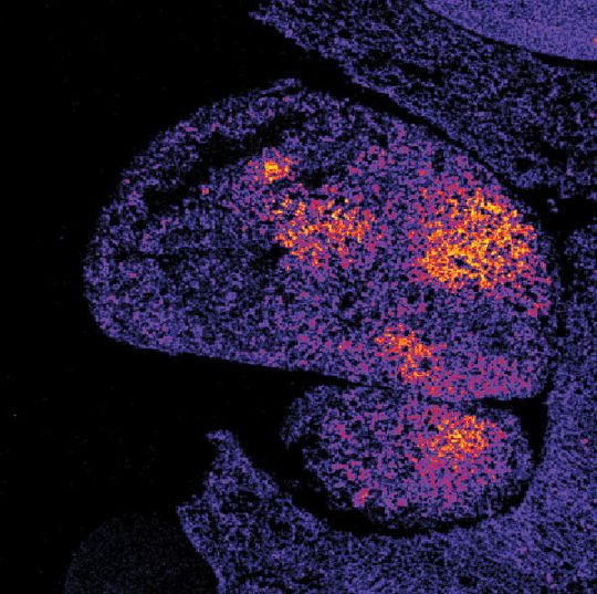 Oxidantienbildung in der Leber – mit einem neuen Biosensor auf einem Gewebeschnitt sichtbar gemacht. Oxidantienbildung in der Leber – mit einem neuen Biosensor auf einem Gewebeschnitt sichtbar gemacht.