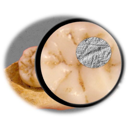 Die Dental Microwear Texture Analysis – die Zahnabnutzungsanalyse, die in der Studie verwendet wurde –, umfasst die Untersuchung und Analyse von winzigen Abnutzungsspuren auf der Zahnoberfläche im Größenbereich unter einem Mikrometer. Die Dental Microwear Texture Analysis – die Zahnabnutzungsanalyse, die in der Studie verwendet wurde –, umfasst die Untersuchung und Analyse von winzigen Abnutzungsspuren auf der Zahnoberfläche im Größenbereich unter einem Mikrometer.
