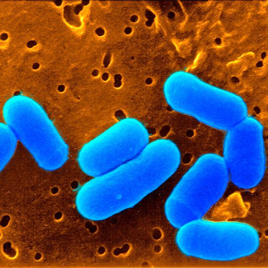 Mit dem Corynebacterium glutamicum werden jährlich mehrere Millionen Tonnen Aminosäuren produziert, wie zum Beispiel der Futtermittelzusatz L-Lysin. Das Bakterium dient jedoch auch als ungefährlicher Modellorganismus für den eng verwandten Erreger der Tuberkulose, mit dem es viele Gemeinsamkeiten hat. (Bildausschnitt) Mit dem Corynebacterium glutamicum werden jährlich mehrere Millionen Tonnen Aminosäuren produziert, wie zum Beispiel der Futtermittelzusatz L-Lysin. Das Bakterium dient jedoch auch als ungefährlicher Modellorganismus für den eng verwandten Erreger der Tuberkulose, mit dem es viele Gemeinsamkeiten hat. (Bildausschnitt)