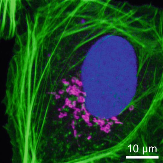 Abb. 2: Drei verschiedene Sonden (Phalloidin, Azid und Antikörper) wurden mit demselben Fluoreszenzfarbstoff (ATTO 488) markiert, wodurch drei Zellstrukturen sichtbar gemacht werden konnten: Das Aktin-Zellskelett (grün), die DNA im Zellkern (blau) und der so genannte Golgi-Apparat (magenta). Dieses Ergebnis hebt die extrem hohe Sensitivität des sFLIM-Verfahrens hervor. Abb. 2: Drei verschiedene Sonden (Phalloidin, Azid und Antikörper) wurden mit demselben Fluoreszenzfarbstoff (ATTO 488) markiert, wodurch drei Zellstrukturen sichtbar gemacht werden konnten: Das Aktin-Zellskelett (grün), die DNA im Zellkern (blau) und der so genannte Golgi-Apparat (magenta). Dieses Ergebnis hebt die extrem hohe Sensitivität des sFLIM-Verfahrens hervor.
