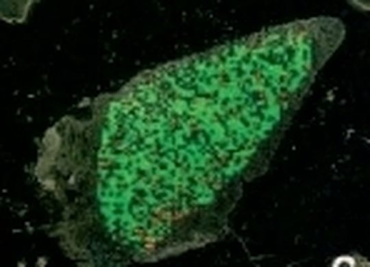 Gesundes Gewebe bei einer histologischen Untersuchung. Gesundes Gewebe bei einer histologischen Untersuchung.