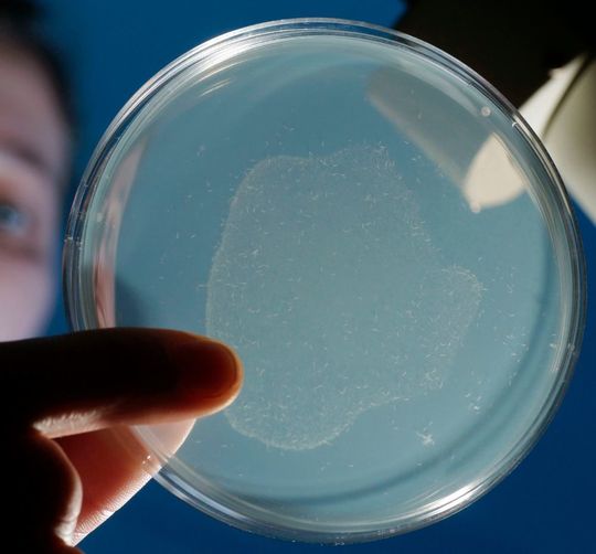 Mit dem bloßen Auge in der Petrischale kaum zu sehen, aber für die Forschung enorm wichtig: Der Fadenwurm Caenorhabditis elegans. Mit dem bloßen Auge in der Petrischale kaum zu sehen, aber für die Forschung enorm wichtig: Der Fadenwurm Caenorhabditis elegans.