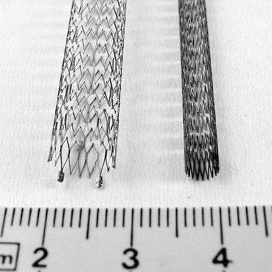 Die Formgedächtnislegierung Nitinol wird bereits sehr erfolgreich in der Medizintechnik für sogenannte Stents – medizinische Gefäßstützen – eingesetzt. Die Formgedächtnislegierung Nitinol wird bereits sehr erfolgreich in der Medizintechnik für sogenannte Stents – medizinische Gefäßstützen – eingesetzt.