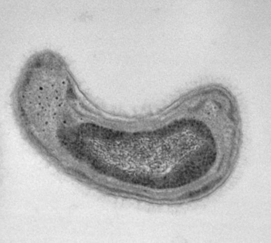 Das Bakterium Methylosinus trichosporium hat durch seinen speziellen Stoffwechsel einen hohen Bedarf an Kupfer. Das Bakterium Methylosinus trichosporium hat durch seinen speziellen Stoffwechsel einen hohen Bedarf an Kupfer.