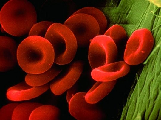 Abb. 1 Rote Blutzellen bilden die Grundlage für das Invitek Invimag Blood Mini Kit/KFml zur Isolation genomischer DNA aus Vollblut. Abb. 1 Rote Blutzellen bilden die Grundlage für das Invitek Invimag Blood Mini Kit/KFml zur Isolation genomischer DNA aus Vollblut.