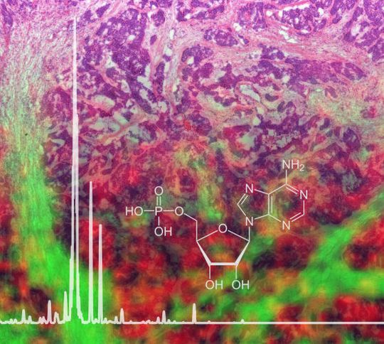 Ein neues Protokoll für die bildgebende Massenspektrometrie erlaubt die Analyse von Stoffwechselprodukten wie Adenosinmonophosphat aus fixiertem Gewebe, hier im Hintergrund dargestellt. Ein neues Protokoll für die bildgebende Massenspektrometrie erlaubt die Analyse von Stoffwechselprodukten wie Adenosinmonophosphat aus fixiertem Gewebe, hier im Hintergrund dargestellt.
