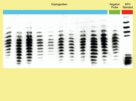 Abb.1: Auf einem typischen EPO- Bild sind die EPO- Isoformen als Banden sichtbar. Abb.1: Auf einem typischen EPO- Bild sind die EPO- Isoformen als Banden sichtbar.