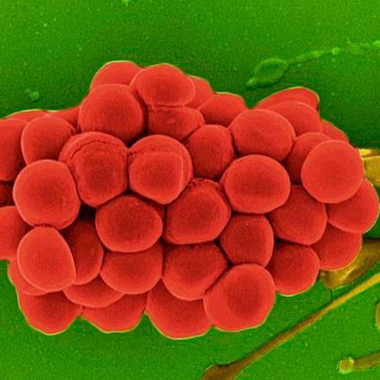 Die rasterelektronenmikroskopische Aufnahme zeigt Zellen des Eiter-Erregers Staphylococcus aureus. Bakterien dieser Spezies verursachen beispielsweise Wundinfektionen. Die rasterelektronenmikroskopische Aufnahme zeigt Zellen des Eiter-Erregers Staphylococcus aureus. Bakterien dieser Spezies verursachen beispielsweise Wundinfektionen.
