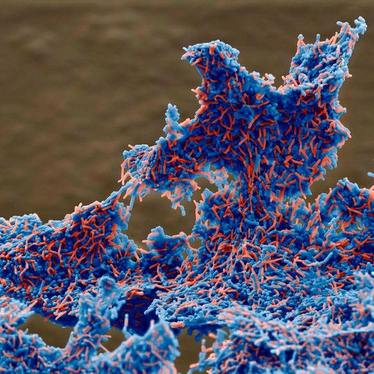 Das Foto zeigt die Co-Aggregation von Pylopass (blau) und Helicobacter pylori (rot). Rasterelektronenmikroskop-Aufnahme (REM) in 1800-facher Vergrößerung. Das Foto zeigt die Co-Aggregation von Pylopass (blau) und Helicobacter pylori (rot). Rasterelektronenmikroskop-Aufnahme (REM) in 1800-facher Vergrößerung.