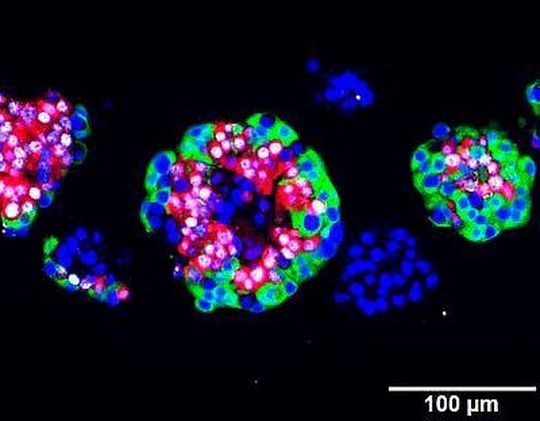 Menschliche Langerhans Inseln, mit 10 mM Artemisinin behandelt und immunofluoreszent gefärbt: Zellkern (blau), ARX (weiß), Glukagon (rot) und C-Peptid (grün) Menschliche Langerhans Inseln, mit 10 mM Artemisinin behandelt und immunofluoreszent gefärbt: Zellkern (blau), ARX (weiß), Glukagon (rot) und C-Peptid (grün)