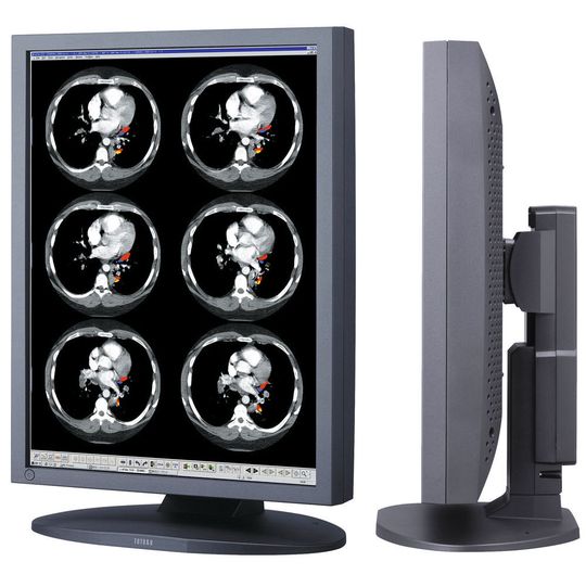 Der Monitor CCL214 von Totoku soll Röntgenbilder immer in der gleichen guten Qualität darstellen Der Monitor CCL214 von Totoku soll Röntgenbilder immer in der gleichen guten Qualität darstellen