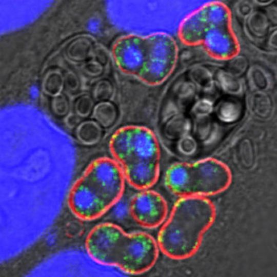 Die Immunofuoreszenzmikroskop-Aufnahme zeigt Mikrosporidien der Art Trachipleistophora hominis in kultivierten Nierenzellen; die Hüllmembran der Parasiten sind rot gefärbt, Mitosomen leuchten grün, die DNA der Zellkerne erscheint blau. Die Immunofuoreszenzmikroskop-Aufnahme zeigt Mikrosporidien der Art Trachipleistophora hominis in kultivierten Nierenzellen; die Hüllmembran der Parasiten sind rot gefärbt, Mitosomen leuchten grün, die DNA der Zellkerne erscheint blau.